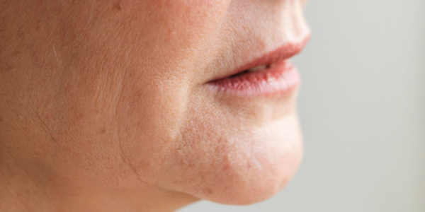 Gezicht met rokershuid